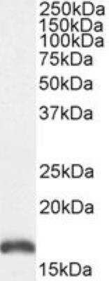 Western Blot: PBR Antibody [NBP1-51934]