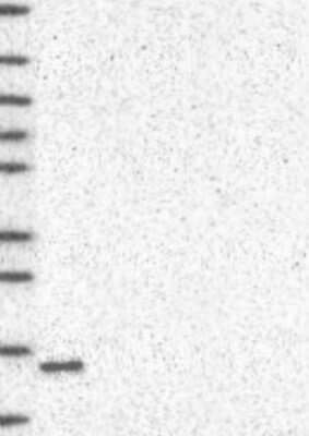 Western Blot: PBR Antibody [NBP3-17663]