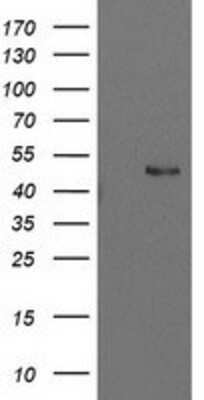 Western Blot: PBX1 Antibody (OTI1C11) [NBP2-00872]