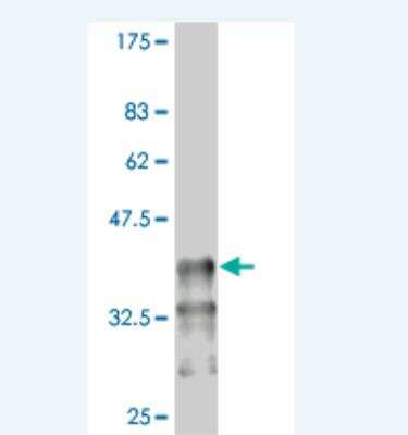 Western Blot: PBX1 Antibody (2D6) [H00005087-M04]