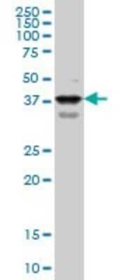 Western Blot: PBX1 Antibody (3F7) [H00005087-M02]