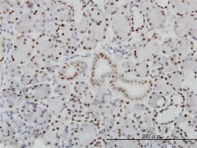 Immunohistochemistry-Paraffin: PBX1 Antibody (4A2) [H00005087-M01]