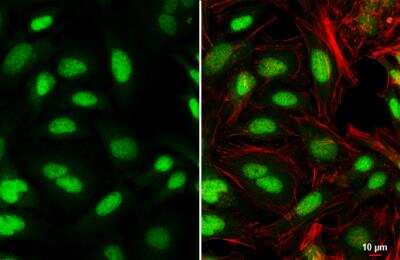 Immunocytochemistry/ Immunofluorescence: PBX1 Antibody [NBP2-19713]