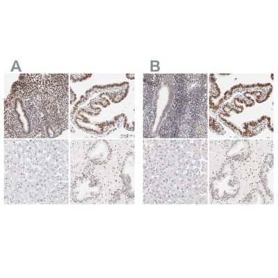 Immunohistochemistry-Paraffin: PBX1 Antibody [NBP1-85803]