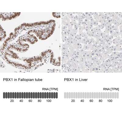 Immunohistochemistry-Paraffin: PBX1 Antibody [NBP1-85803]