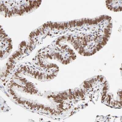 Immunohistochemistry-Paraffin: PBX1 Antibody [NBP1-85803]