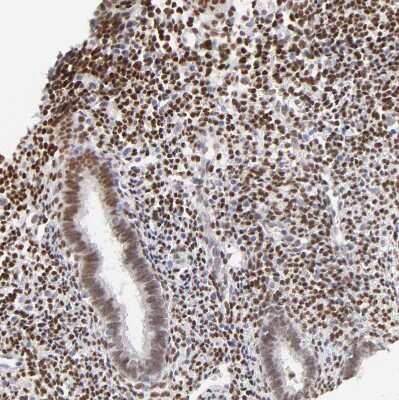 Immunohistochemistry-Paraffin: PBX1 Antibody [NBP1-85803]