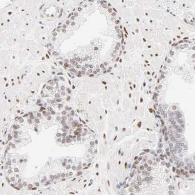 Immunohistochemistry-Paraffin: PBX1 Antibody [NBP1-85803]