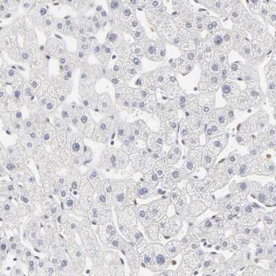 Immunohistochemistry-Paraffin: PBX1 Antibody [NBP1-85803]
