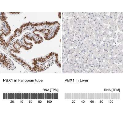 Immunohistochemistry-Paraffin: PBX1 Antibody [NBP1-86151]