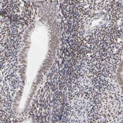 Immunohistochemistry-Paraffin: PBX1 Antibody [NBP1-86151]