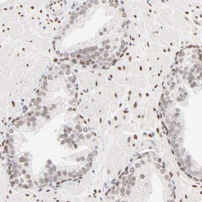 Immunohistochemistry-Paraffin: PBX1 Antibody [NBP1-86151]