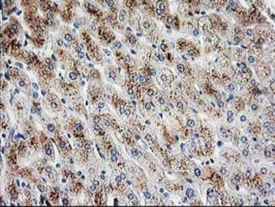 Immunohistochemistry: PBX1 Antibody (OTI1C11) - Azide and BSA Free [NBP2-73265]