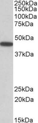 Western Blot: PBX1 Antibody [NBP1-52042]