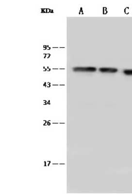 Western Blot: PBX1 Antibody [NBP2-99369]