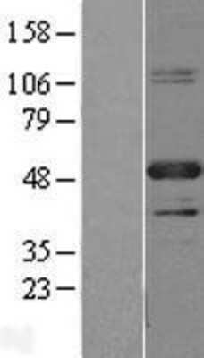 Western Blot: PBX1 Overexpression Lysate [NBL1-14137]