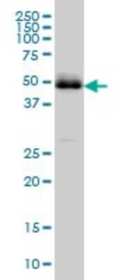 Western Blot: PBX2 Antibody (2E9) [H00005089-M01]