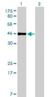 Western Blot: PBX2 Antibody (2E9) [H00005089-M01]