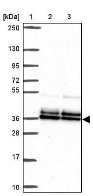 Western Blot: PBX2 Antibody [NBP2-31853]