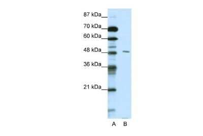 Western Blot: PBX2 Antibody [NBP2-85445]