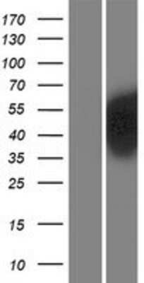 Western Blot: PBX2 Overexpression Lysate [NBP2-08093]