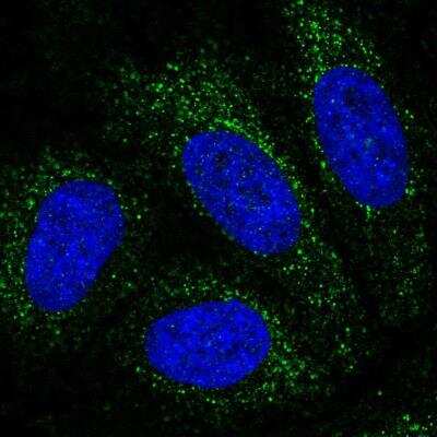 Immunocytochemistry/ Immunofluorescence: PBX4 Antibody [NBP2-76550]