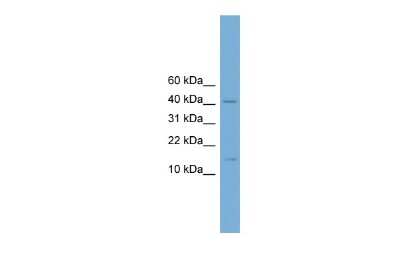 Western Blot: PBX4 Antibody [NBP2-88015]