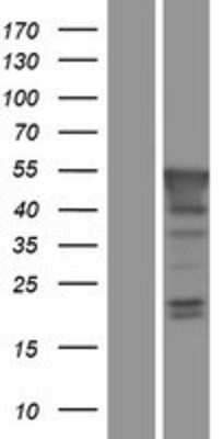 Western Blot: PBX4 Overexpression Lysate [NBP2-06218]