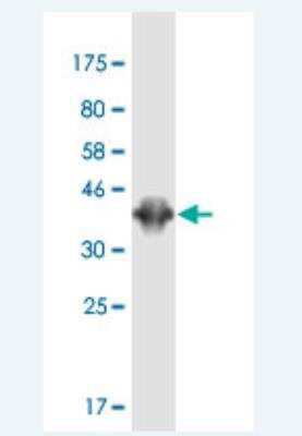 Western Blot: PBXIP1 Antibody (7E1) [H00057326-M02-100ug]