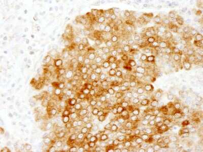 Immunohistochemistry-Paraffin: PBXIP1 Antibody [NB100-81652]
