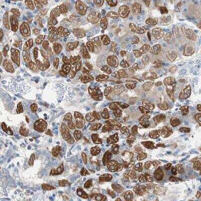 Immunohistochemistry-Paraffin: PBXIP1 Antibody [NBP1-83222]