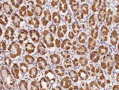 Immunohistochemistry-Paraffin: PBXIP1 Antibody [NBP3-05982]