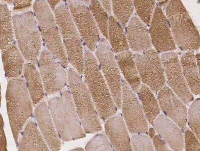 Immunohistochemistry-Paraffin: PBXIP1 Antibody [NBP3-05982]