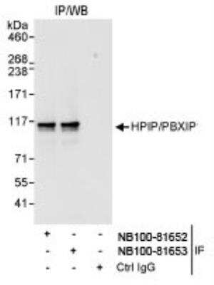 Immunoprecipitation: PBXIP1 Antibody [NB100-81653]