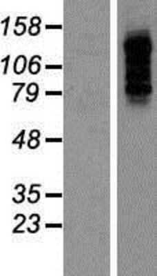 Western Blot: PBXIP1 Overexpression Lysate [NBP2-06635]