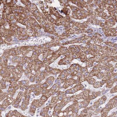 Immunohistochemistry-Paraffin: Proprotein Convertase 1/PCSK1 Antibody [NBP2-13741]