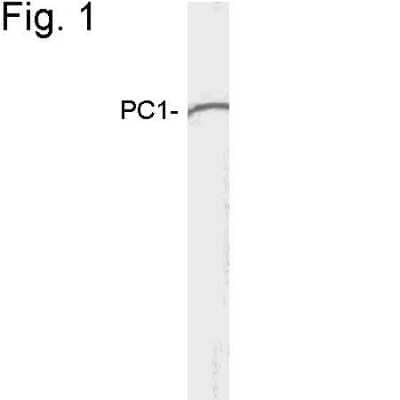 Western Blot: Proprotein Convertase 1/PCSK1 Antibody [NB120-3532]