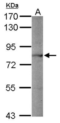 Western Blot: Proprotein Convertase 1/PCSK1 Antibody [NBP2-19714]