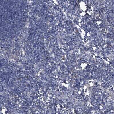 Immunohistochemistry-Paraffin: PC6 Antibody [NBP1-87326]