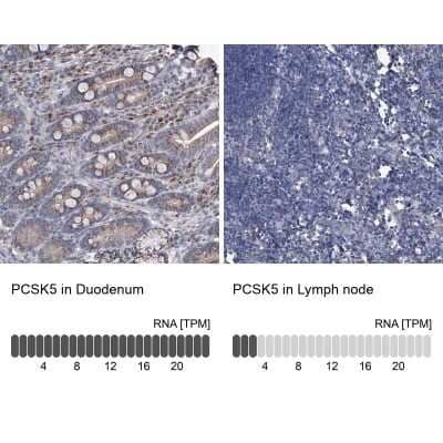 Immunohistochemistry-Paraffin: PC6 Antibody [NBP1-87326]