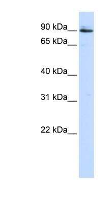 Western Blot: PC6 Antibody [NBP1-57908]