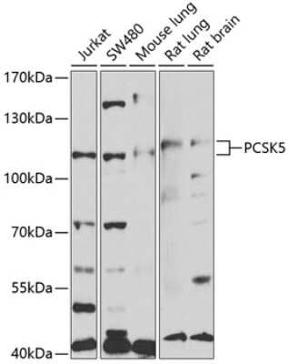 Western Blot: PC6 AntibodyBSA Free [NBP2-94153]