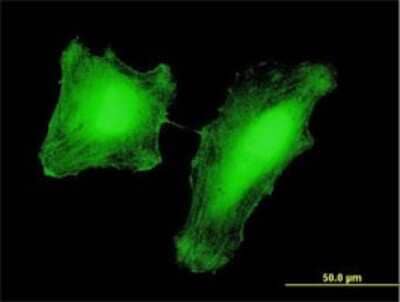 Immunocytochemistry/ Immunofluorescence: PCAF Antibody (2B4) [H00008850-M01]