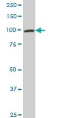 Western Blot: PCAF Antibody (5E5) [H00008850-M06]