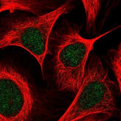 Immunocytochemistry/ Immunofluorescence: PCAF Antibody [NBP2-58285]