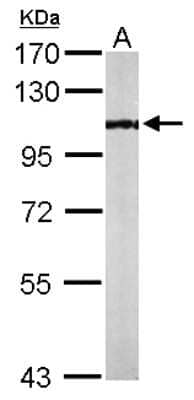 Western Blot: PCAF Antibody [NBP1-31192]