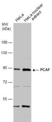 Western Blot: PCAF Antibody [NBP1-31192]