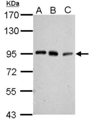 Western Blot: PCAF Antibody [NBP1-31192]