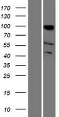 Western Blot: PCAF Overexpression Lysate [NBP2-10550]