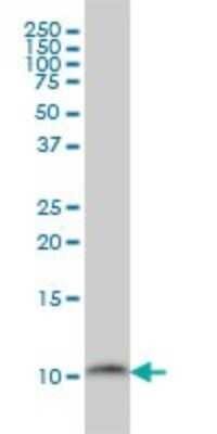 Western Blot: PCBD1 Antibody (1G11-H5) [H00005092-M01]